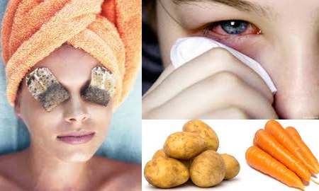 Remedios naturales para la conjuntivitis