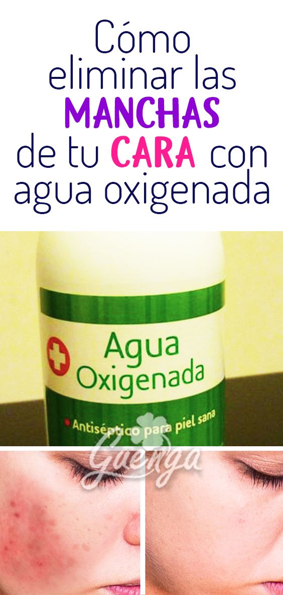 Agua oxigenada en la piel
